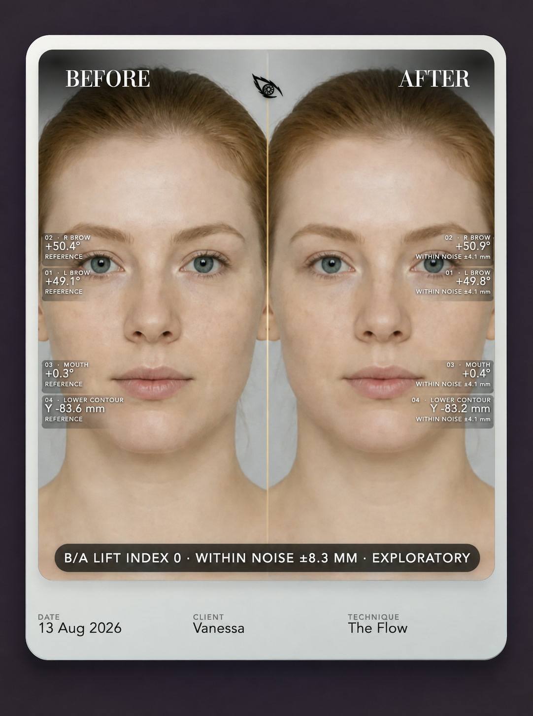 An unchanged face scored Lift Index 0 and labelled within noise